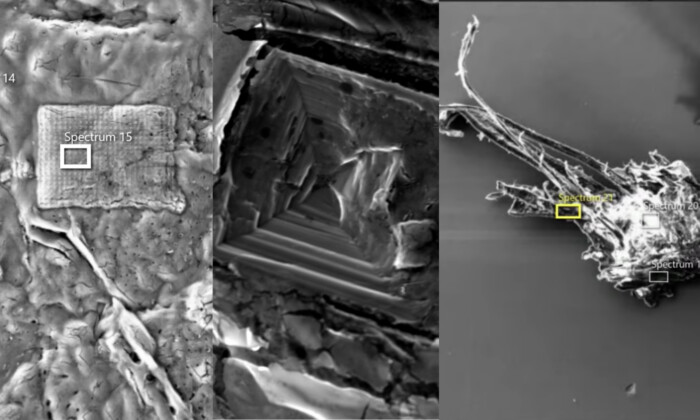 Image MET (Microscopie électronique à transmission) de flacons de vaccins. (Avec l'aimable autorisation du Dr Daniel Nagase)