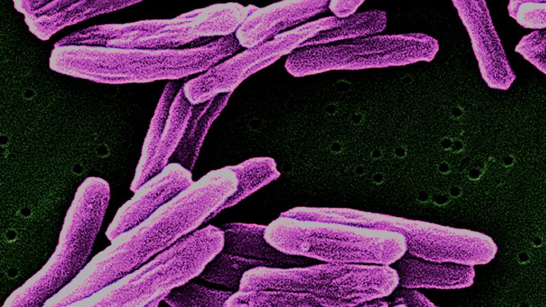 Mycobacterium-tuberculosis (Janice Haney Carr, Dr. Ray Butler, USCDCP/Pixnio CC0)