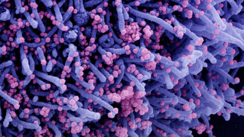 Micrographie électronique à balayage colorisée d'une cellule (en violet) infectée par une souche variante des particules virales du SRAS-CoV-2 (en rose). (NIAID via Epoch Times)