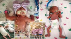 Pour sauver la vie de sa sœur, une jumelle envoie des signaux de détresse obligeant les médecins à les faire naître prématurément