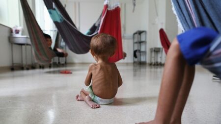 Brésil: des enfants yanomami dénutris soignés dans un hôpital d’Amazonie