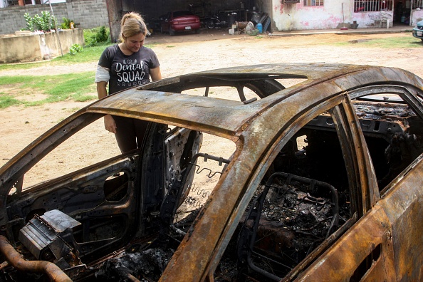 Leidy Faria et son mari ont été brûlés lors de l'incendie de leur véhicule à Maracaibo, au Venezuela, le 30 avril 2023. (LUIS BRAVO/AFP via Getty Images)