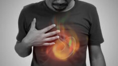Vous souffrez de reflux gastro-œsophagien ? Essayez ces remèdes miraculeux