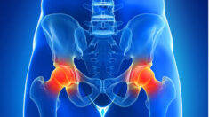 Douleur chronique de la hanche : les 5 meilleurs exercices (niveau facile) d’un thérapeute