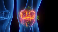 Douleur chronique du genou : 2e cause de douleur, 5 exercices faciles à faire à la maison pour soulager la douleur