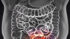 8 principaux facteurs de risque du cancer colorectal et 3 conseils pour préserver la santé digestive
