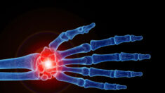 La douleur chronique du poignet peut subsister pendant des années, les meilleurs exercices pour la soulager   