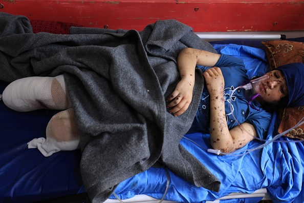 Layan al-Baz, amputée de 13 ans, reçoit un traitement à l'hôpital Nasser de Khan Yunis, dans le sud de la bande de Gaza le 31 octobre 2023. (Photo MAHMUD HAMS/AFP via Getty Images)