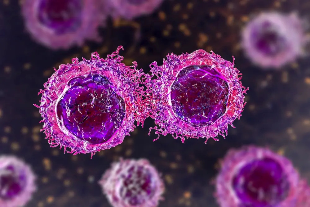 Le traitement ou l'absence de traitement d'un cancer de la prostate localisé donne des résultats similaires sur 15 ans, mais une question est soulevée
