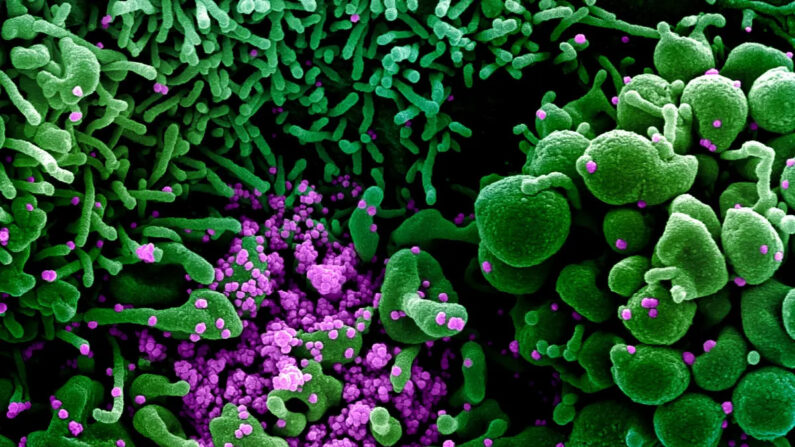 Une cellule (en vert) fortement infectée par des particules de COVID-19 (en violet), isolée à partir d'un échantillon de patient le 16 mars 2020. (NIAID)