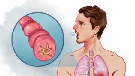 Le guide essentiel de l’asthme : symptômes, causes, traitements et approches naturelles
