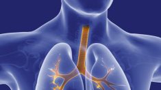 Cinq exercices pour soulager l’essoufflement de l’asthme