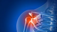 Douleur chronique de l’épaule : souvent causée par des déséquilibres musculaires, 5 exercices pour restaurer le mouvement, la force et l’équilibre