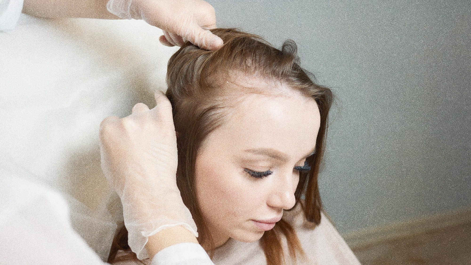 Comment les femmes peuvent prévenir la perte de cheveux en nourrissant le foie et les reins